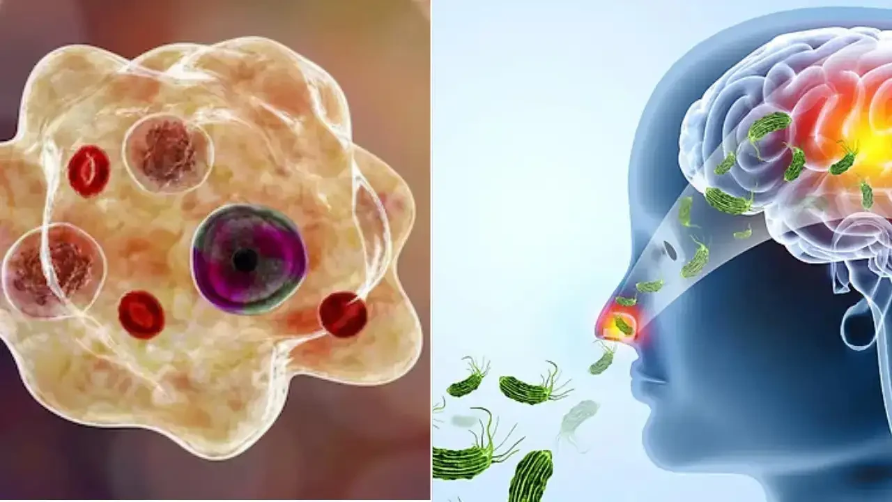 केरल में 2025 में अमीबिक एन्सेफलाइटिस से 42 मौतें, मामलों में लगातार वृद्धि
