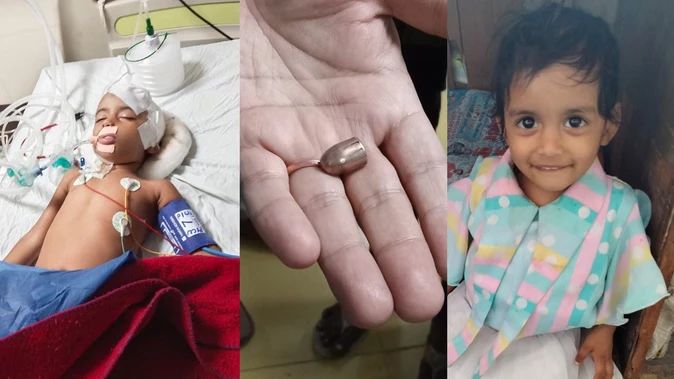 इंदिरा नगर में डरावनी घटना: तीन साल की बच्ची के सिर में लगी गोली