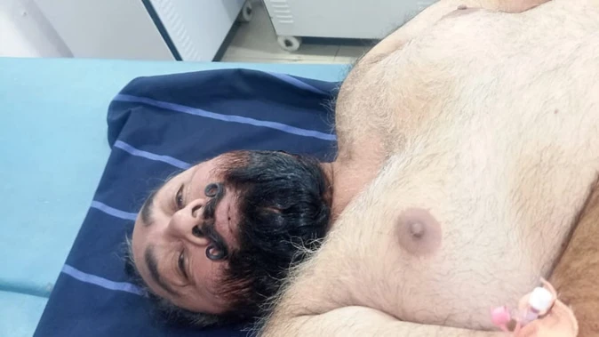 मोगा में पूर्व पार्षद पर गोलीबारी, दो हमलावर फरार