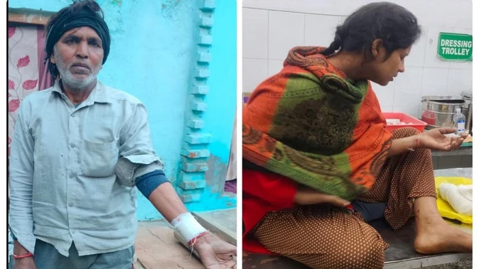 बागपत में पागल कुत्ते का आतंक, छात्रा सहित सात ग्रामीण घायल