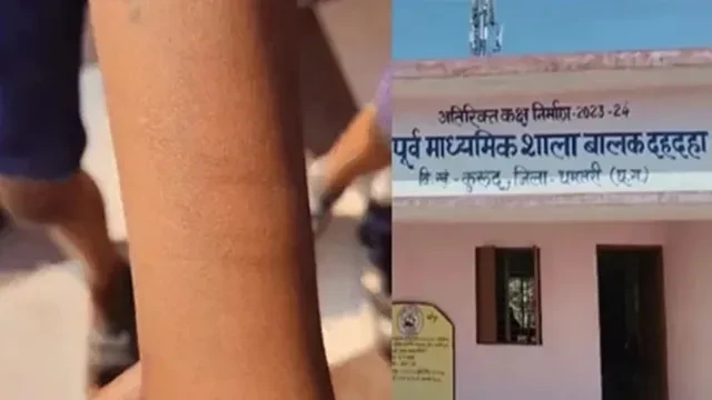 धमतरी: स्कूल में 35 बच्चों ने अपनी कलाई काटी, प्रशासन और एबीवीपी में हड़कंप