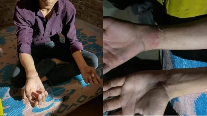 खाकी का खौफनाक रूप: 10वीं के छात्र को दी थर्ड डिग्री, पीट-पीटकर तोड़ी कलाई