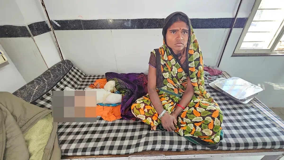 छतरपुर: झोपड़ी में लगी आग, छह माह की बच्ची गंभीर रूप से झुलसी