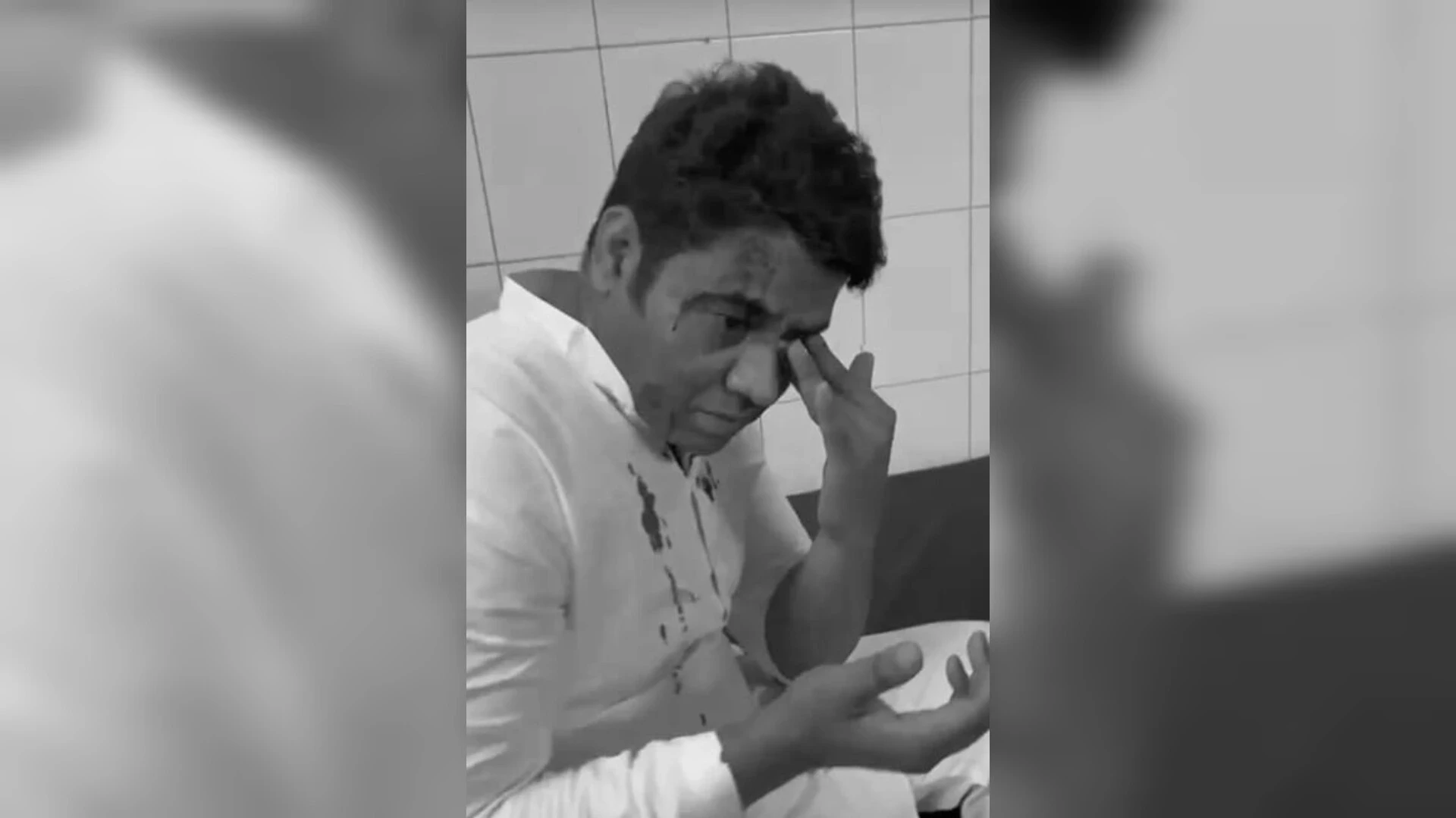 गाजियाबाद में यूथ कांग्रेस नेता आसिफ सैफी पर बेसबॉल बैट से हमला