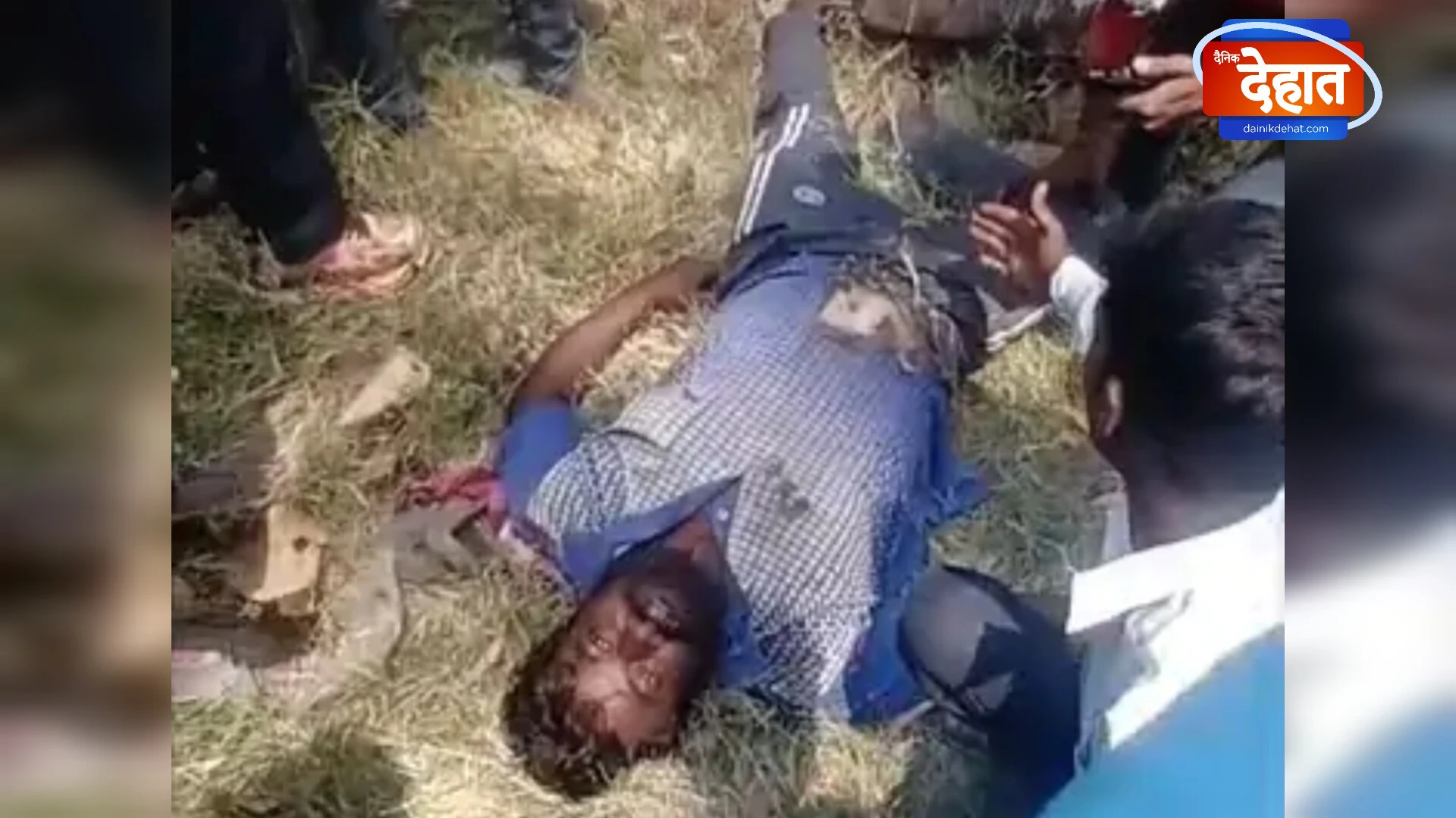 मुजफ्फरनगर में ट्रांसफॉर्मर पर काम करते समय विद्युत कर्मी झुलसा, हालत गंभीर