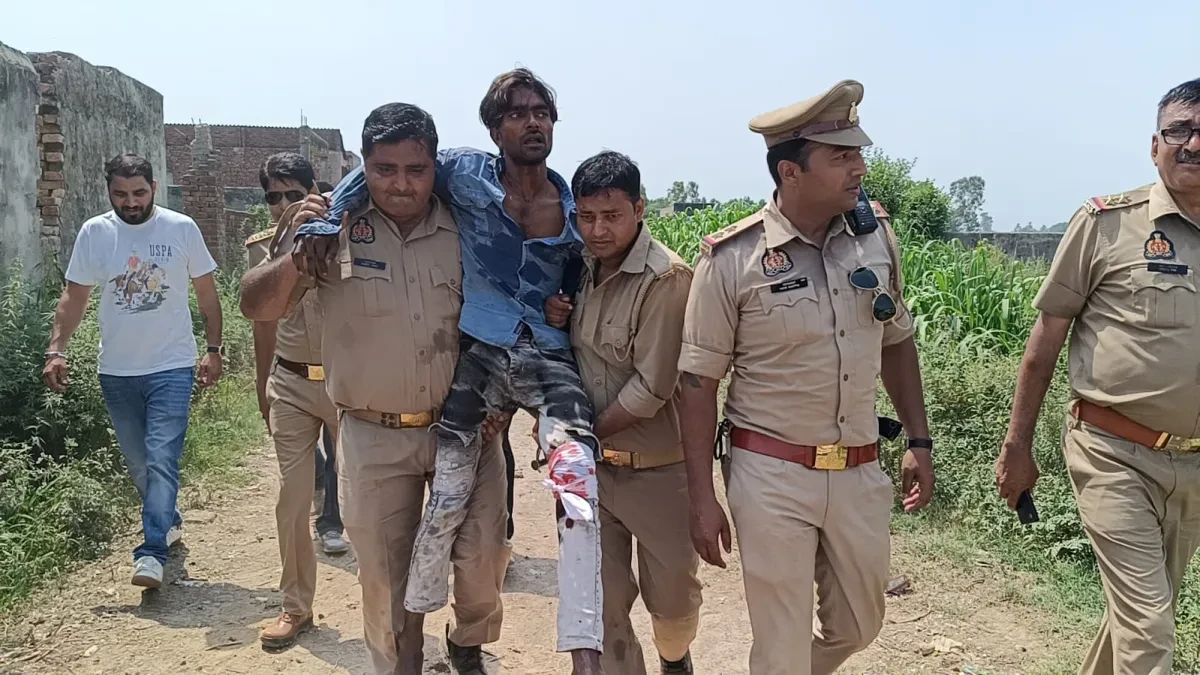 मुजफ्फरनगर: मेडिकल से फरार तेजाब कांड का आरोपी मुठभेड़ में गिरफ्तार, पैर में लगी गोली