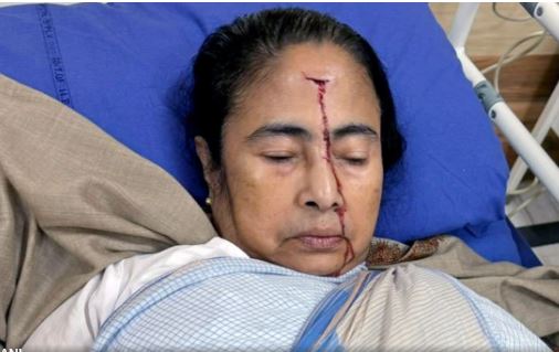 ममता बनर्जी को चोट लगने के मामले में अस्पताल की सफाई, शारीरिक रूप से धक्का नहीं दिया गया