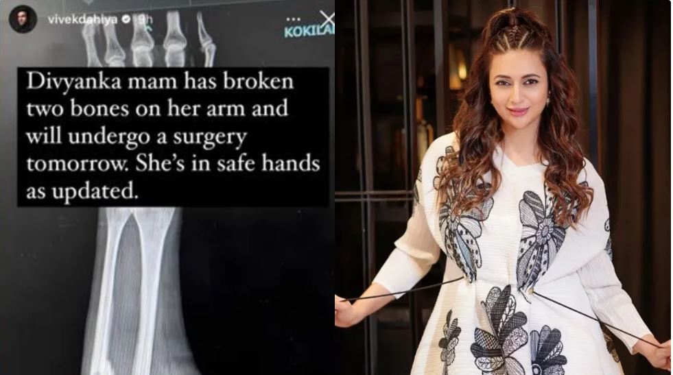 दिव्यांका त्रिपाठी का हुआ एक्सीडेंट, टूटी हाथ की दो हड्डियां