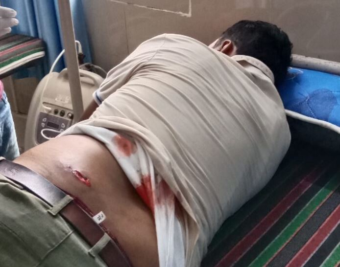 शाहपुर में जामुन तोडऩे को लेकर विवाद में युवक को मारी गोली