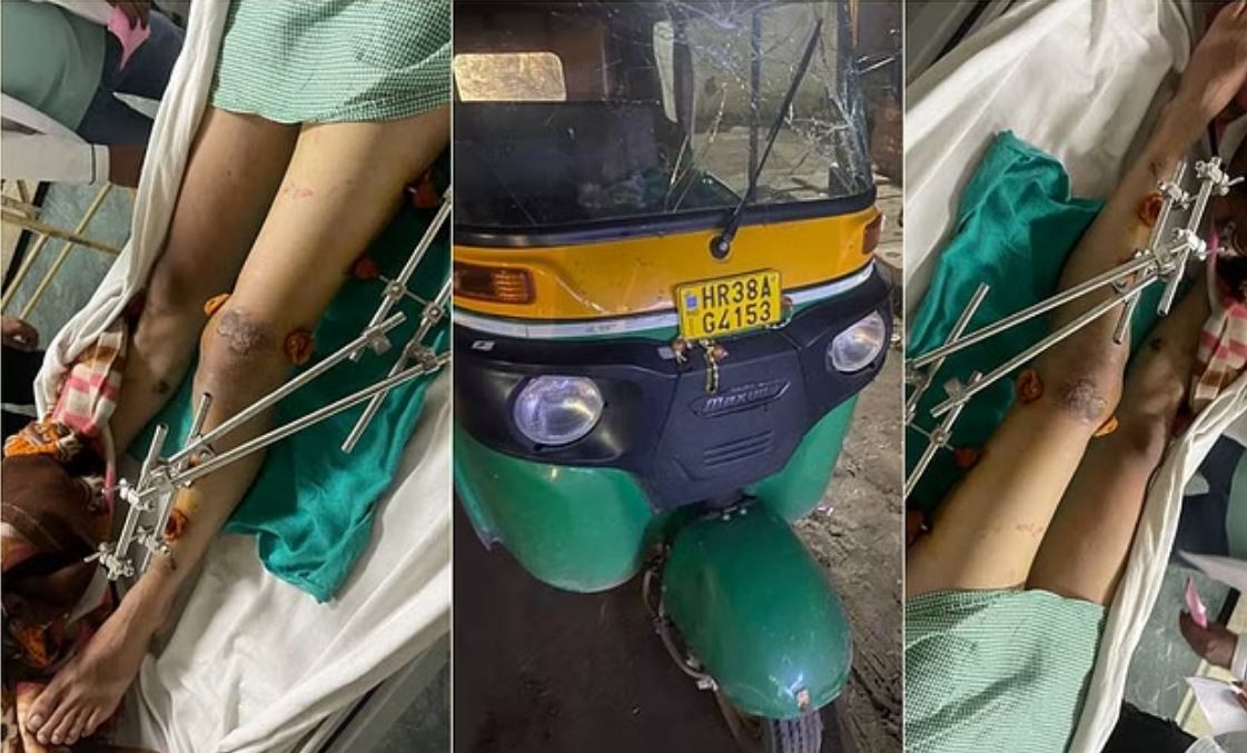 पांच रुपये कम किराया देने पर ऑटो चालक ने मारी छात्र को टक्कर, 300 मीटर तक घसीटा