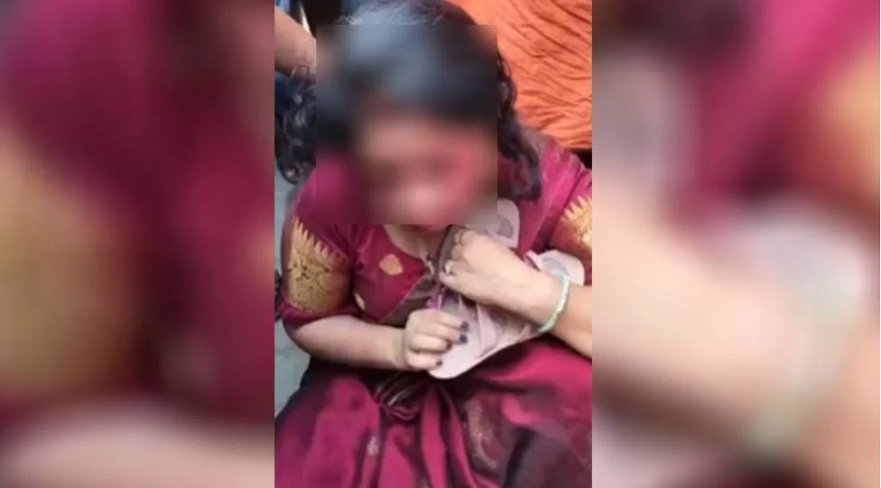 गले में चप्पलों की माला, सूजा हुआ चेहरा, महिला की बेरहमी से पिटाई