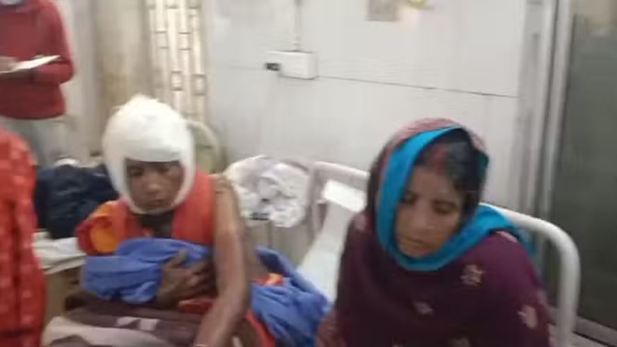 मुजफ्फरपुर: गांजा पीने से रोका तो महिलाओं पर फेंका एसिड, चार लोग झुलसे