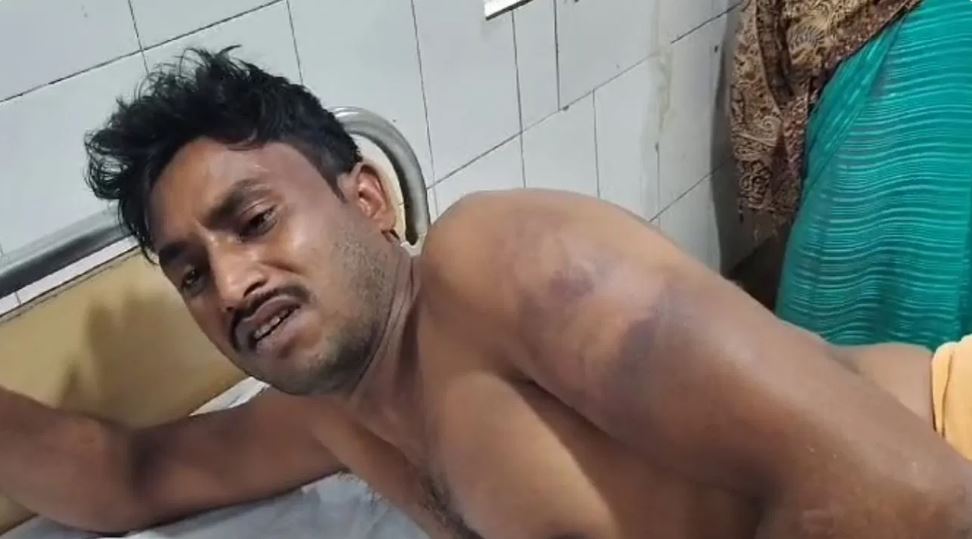 लाठी मारने के मिलेंगे पैसे, वैशाली में सामने आई पुलिस की बर्बरता