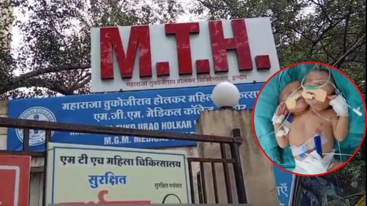 इंदौर में चमत्कारिक जन्म: एक शरीर, दो सिर वाला बच्चा, हालत गंभीर