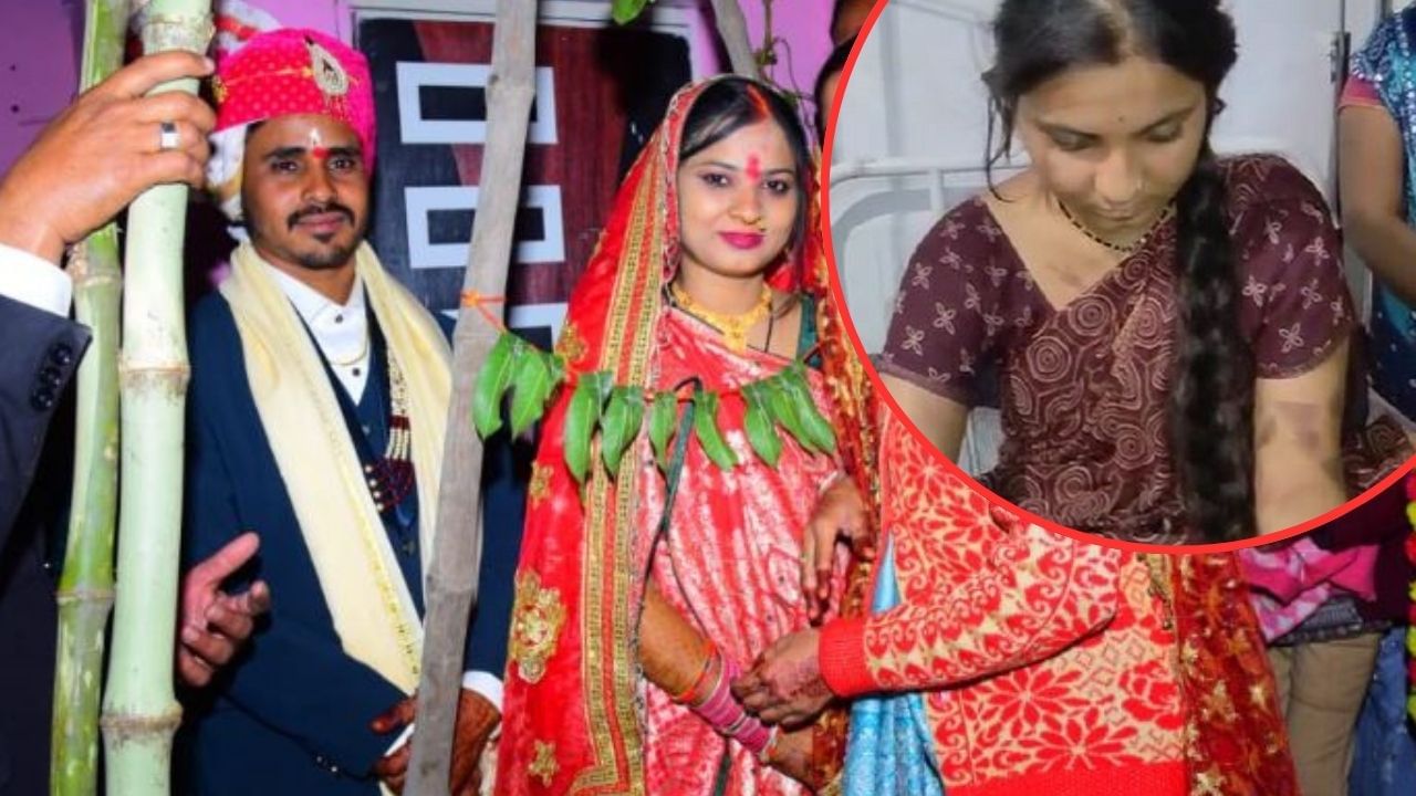 ‘दहेज ला या मर...’, फिर पत्नी पर 50 बार दागा, हैवान पति की करतूत
